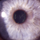 2023-12-14-Live-Lecture-Must-Know-Cornea-Cases-product