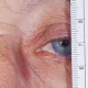 2024-02-15-Live-Lecture-Life-Threatening-Causes-of-Ptosis-product