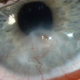 2025-09-18-Live-Lecture-Ocular-Surface-Diseases-in-Children-Crystal-Cheung-product