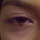 2026-06-18-Live-Lecture-Pediatric-Pink-Eye-Kenneth-Wright-product